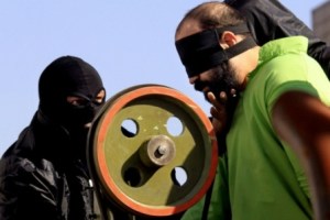 This man is getting ready for amputation of fingers in Iran, after being convicted for burglary. Photo: Mohsen Tavarro.